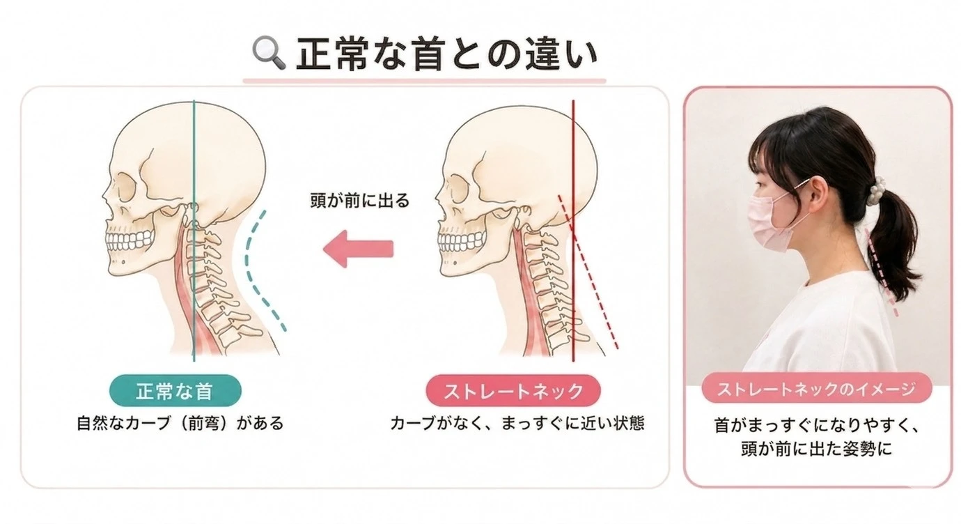 ダウンロード